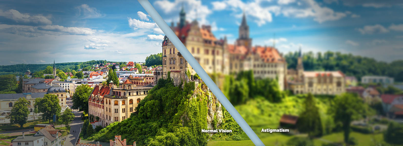 Astigmatism Treatment in Washington